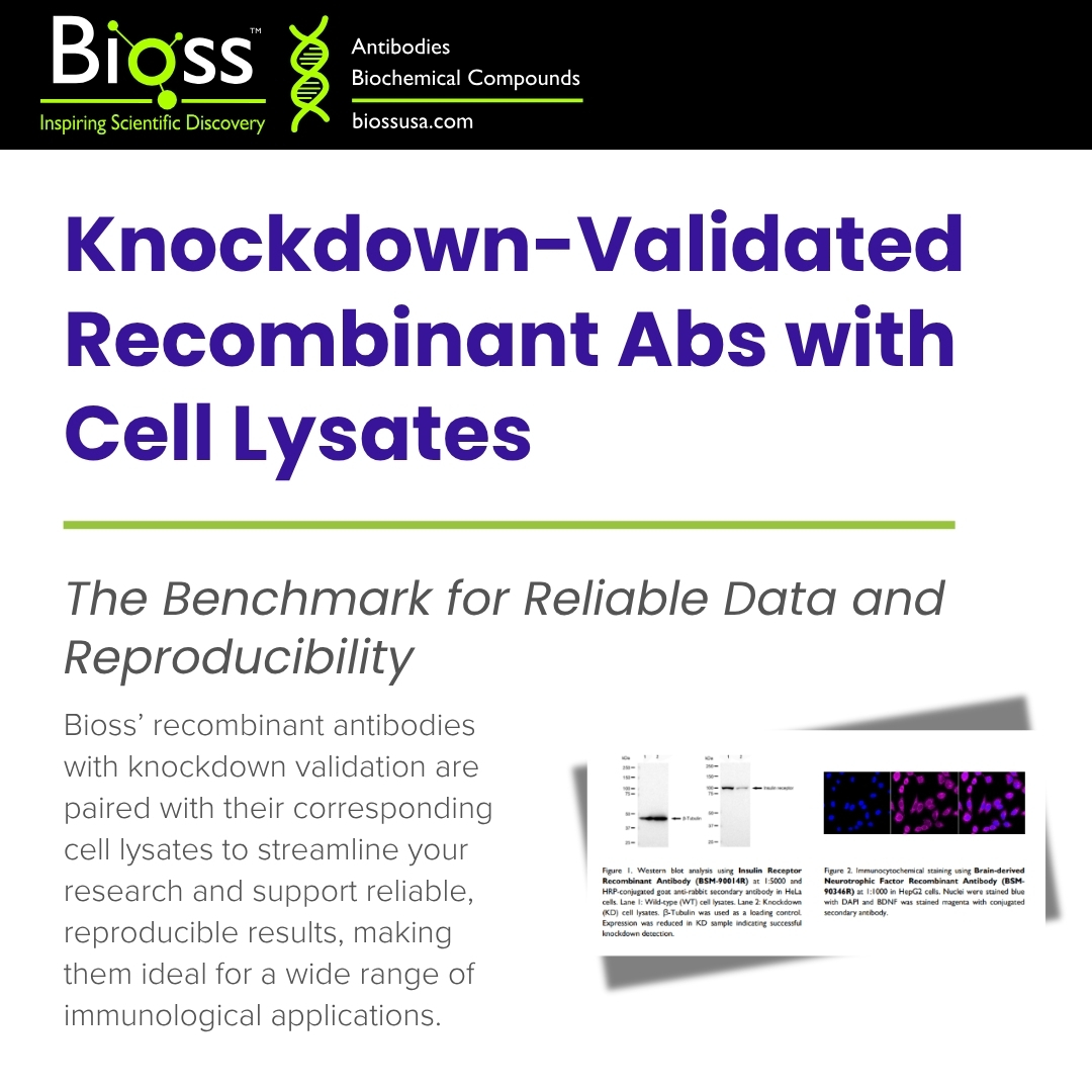 Bioss Knockdown-Validated Recombinant Antibodies are paired with matched lysates for enhanced reliability and better signal specificity.

Explore our portfolio designed to boost confidence in your results here: hubs.ly/Q03GGgmM0
