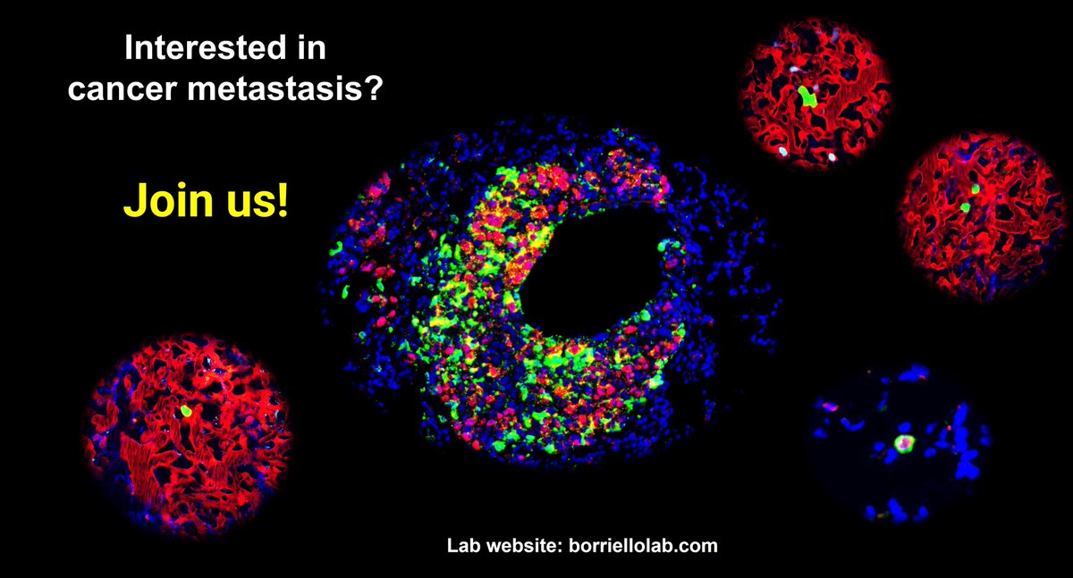 Lucia Borriello (@luciaborriell) on Twitter photo 🚨 Exciting Opportunity Alert! 🚨
Are you passionate about understanding why cancer patients relapse and uncovering the secrets of tumor dormancy and metastasis? 
Join our dynamic lab <a href="/templemedschool/">Temple Med School</a> and <a href="/FoxChaseCancer/">Fox Chase Cancer Center</a> 
✨ Please RT to spread the word! ✨ 🚨 Exciting Opportunity Alert! 🚨
Are you passionate about understanding why cancer patients relapse and uncovering the secrets of tumor dormancy and metastasis? 
Join our dynamic lab <a href="/templemedschool/">Temple Med School</a> and <a href="/FoxChaseCancer/">Fox Chase Cancer Center</a> 
✨ Please RT to spread the word! ✨