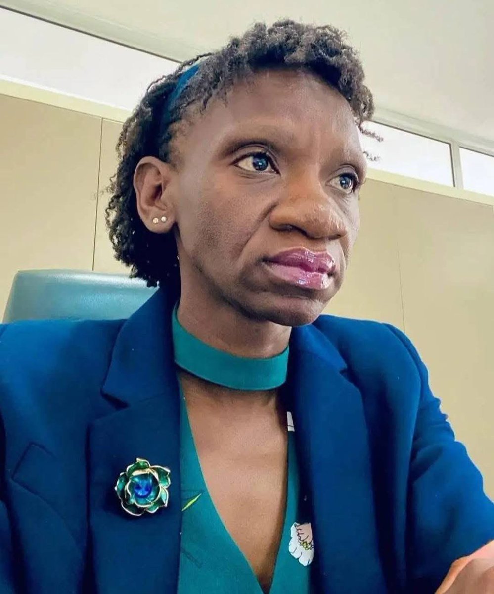 37-year-old Zambia-based lawyer Naomie Pilula has shown incredible strength after facing online mockery about her appearance. 

What started as a simple selfie quickly drew harsh and unkind comments, with some people trying to tear her down. Instead of responding with anger,