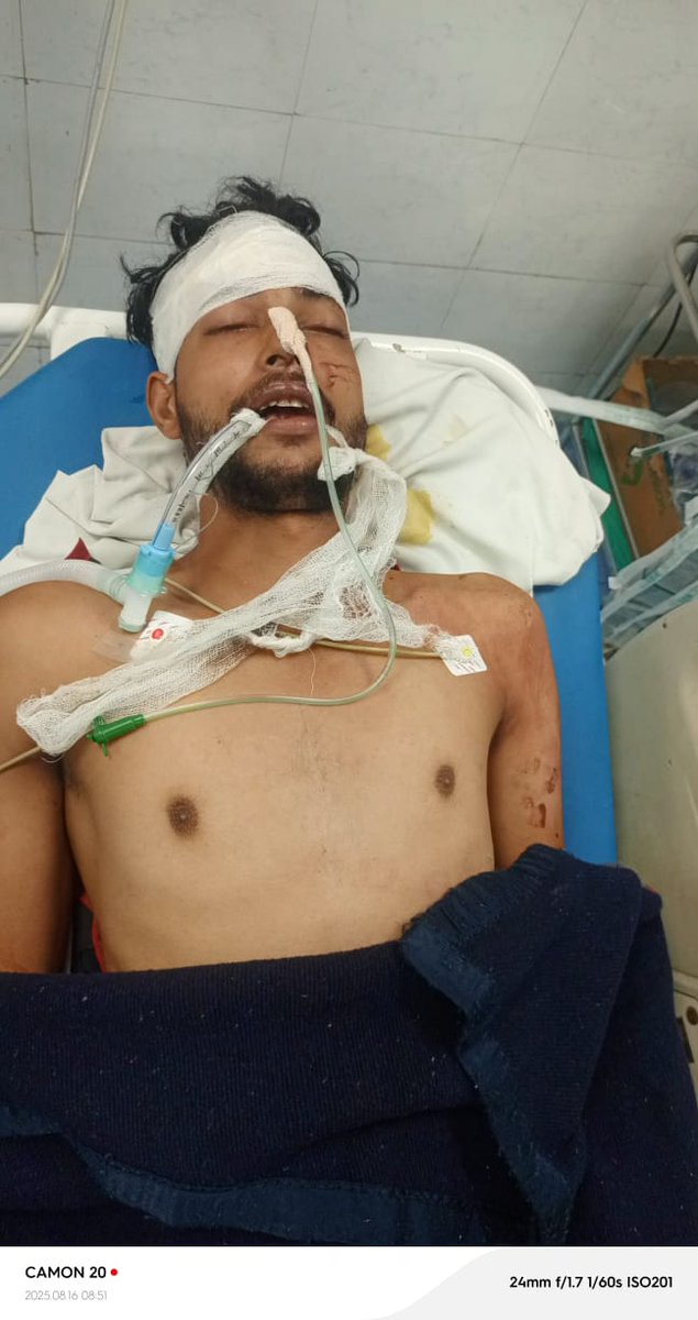 DevendraKumar36's tweet image. सोशल मीडिया दुबार प्राप्त फ़ोटो और लिखित तहरीर की जांच कर नियमानुसार मुकदमा दर्ज करने की कृपा करें @Uppolice @mathurapolice @mainpuripolice @adgzoneagra @agra