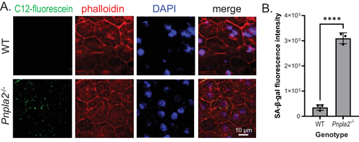 Juan Yang, Alexandra Bernardo-Colón &amp; S. Patricia Becerra <a href="/NatEyeInstitute/">NEI</a> find that lack of Pnpla2 accelerates progression of AMD-Like features in mice.
doi.org/10.1167/iovs.6…