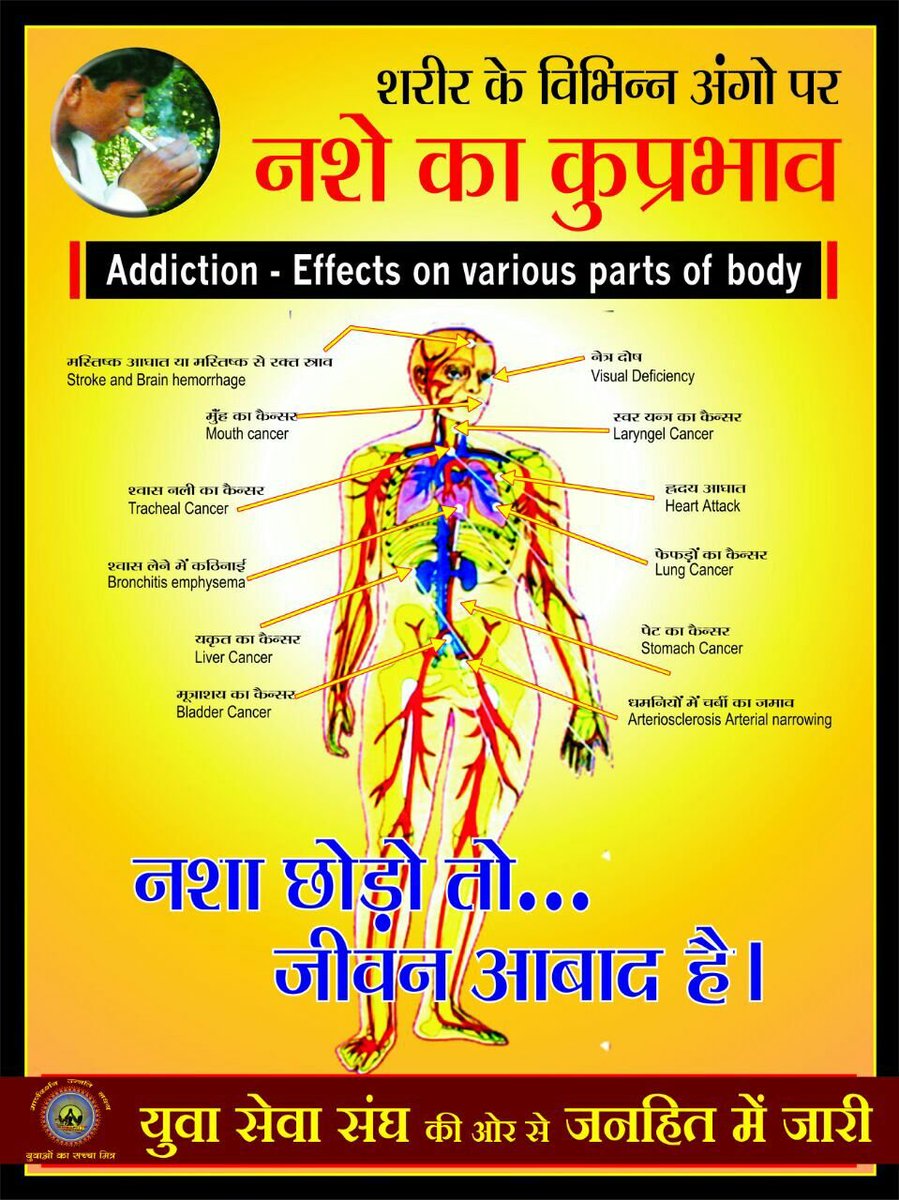 jagohindustani_'s tweet photo. #नशे_से_सावधान करते हुए Sant Shri Asharamji Bapu कहते हैं कि जीवविज्ञानियों ने खोजा है कि जो शराब पीते हैं उनके ब्लड में अल्कोहल का हिस्सा बढ़ जाता है।
उस व्यक्ति के 10वीं पीढ़ी को भी आंख का कैंसर होने की संभावना होती है।
इस हेतु Yuva Sewa Sangh द्वारा Samaj Jagriti लाई जाती है। https://t.co/i4TBu7mr1Y