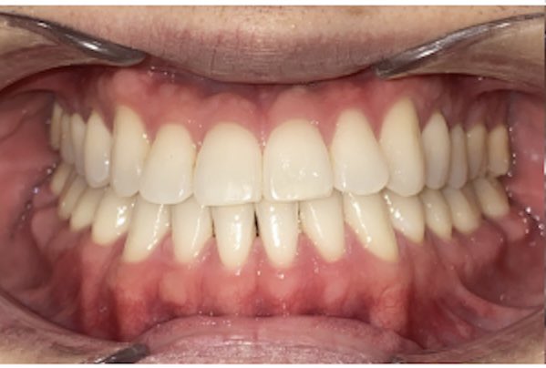 Before and after.  25 long month journey but was worth.