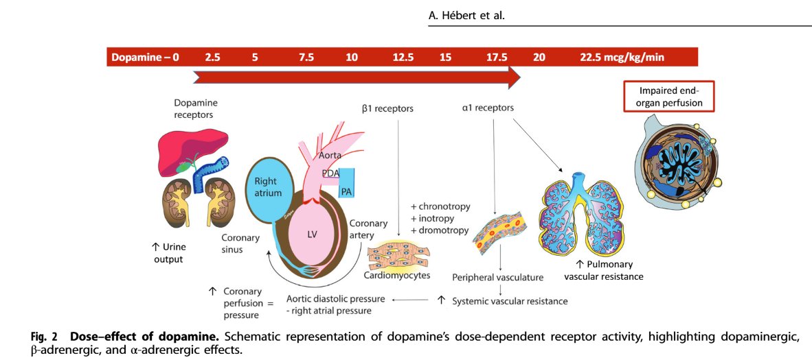 Satyan (@neosatyan) on Twitter photo What is your first line vasoactive agent to treat hypotension/hypoperfusion in the #NICU ? Are you a #dopamine fan? A review article in <a href="/JPerinatology/">Journal of Perinatology</a> by <a href="/CardioNeo/">NeoCardioLab - Gabriel Altit</a> <a href="/HebertAudrey3/">Audrey Hebert</a> <a href="/SBhombalK3/">Shazia Bhombal</a> <a href="/ShiranSMoore/">Shiran Moore</a> <a href="/StephFordNeoPH/">Stephanie Ford, MD</a> and Rios - full text at rdcu.be/eD0jX What is your first line vasoactive agent to treat hypotension/hypoperfusion in the #NICU ? Are you a #dopamine fan? A review article in <a href="/JPerinatology/">Journal of Perinatology</a> by <a href="/CardioNeo/">NeoCardioLab - Gabriel Altit</a> <a href="/HebertAudrey3/">Audrey Hebert</a> <a href="/SBhombalK3/">Shazia Bhombal</a> <a href="/ShiranSMoore/">Shiran Moore</a> <a href="/StephFordNeoPH/">Stephanie Ford, MD</a> and Rios - full text at rdcu.be/eD0jX