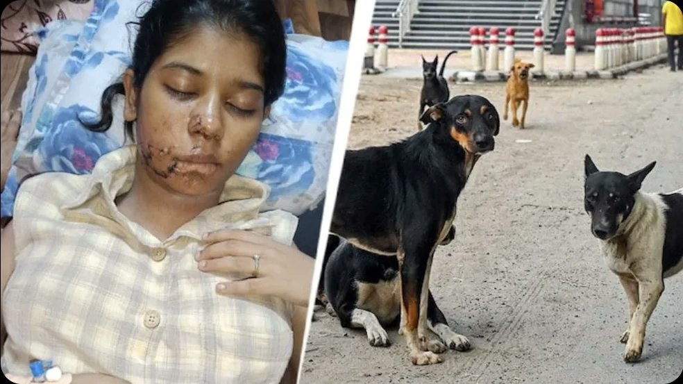 🚨 HORRIFIC incident in Kanpur 

21-yr-old BBA student mauled by STRAY Dogs — needed 17 stitches, face disfigured.