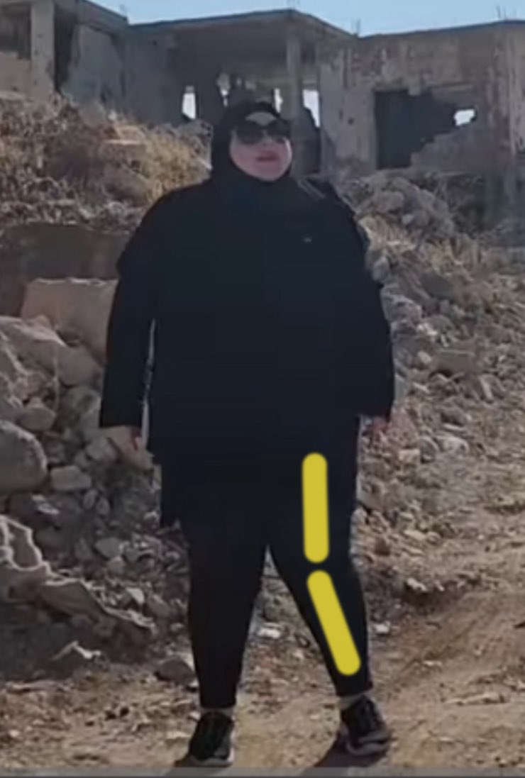 OnlyOneEyeLash's tweet image. Why is #FoodieBeauty ‘s foot not under her knee? And that’s not even her bad, gimpy leg! 

#GorlWorld #KNEES #beeze