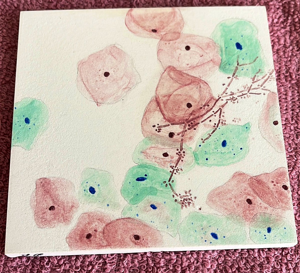 Let’s see how this piece turns out after being fired up. Stay tuned for the post-kiln reveal and see how the colors change. 🎨🔬
#pathart #histoart #pathology #histology