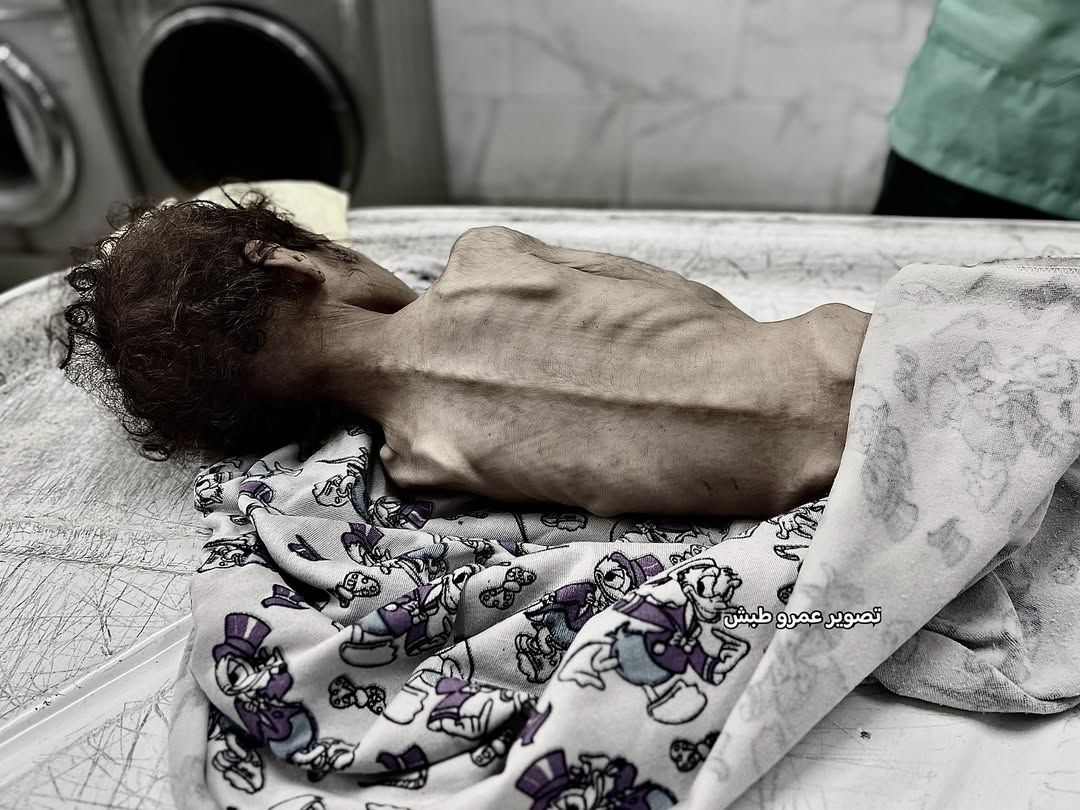 “Gazze’de insanlar sadece bombalardan değil, açlıktan da ölüyor. Bir lokma ekmek, bir damla suya hasret kalan çocukların sesi, dünyanın vicdanına sesleniyor. 🌍🕊️ #Gazze #AçlığaSon”

“Bu çocuk benim de çocuğum olabilirdi… Bunu asla unutma.”