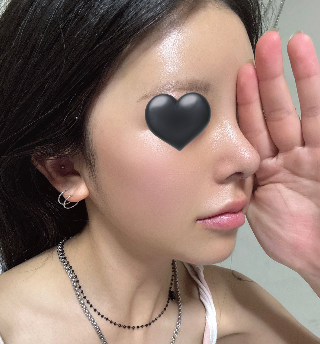 __vm30's tweet photo. 🪡ワンダフル美容外科整形レポ🍀⟡꙳
@wonderfulps_jp https://t.co/lRbdurZmsn