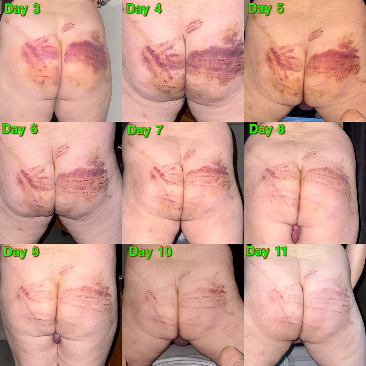 It will take weeks/months for the marks left by my master in 10 minutes to heal completely.

SIR thank you SIR

#gayspanking #gayslave #ownedslave #gaymaster #gaytorture #gaysm #gaypain #gaycbt #gaynipples #tinydick #tinycock #tinyballs #uselessdick  #uselesscock #uselessballs