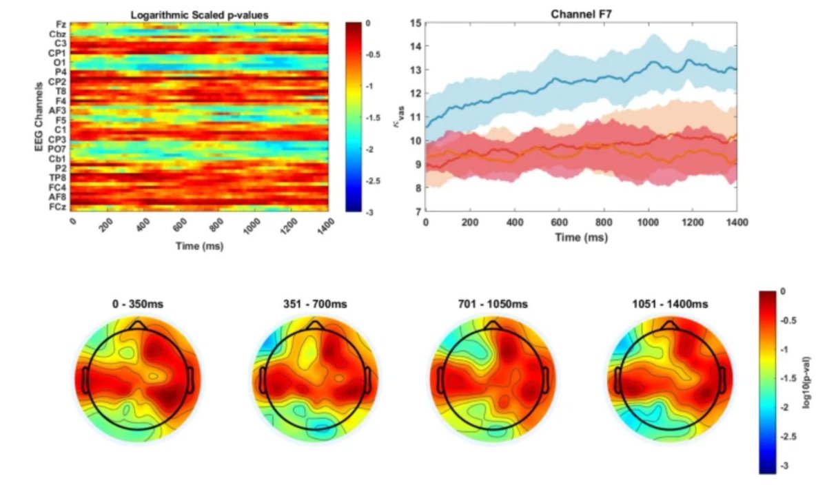 GeroScienceAGE's tweet image. 📢Check Out Our New OA🔓 Paper

Task-specific dynamical entropy variations in EEG as a biomarker for Parkinson’s disease progression by Fatih Onay &amp;amp; Bilge Karaçalı.

rdcu.be/eB38J

#entropy #complexity #parkinsonsdisease #EEG #pedaling #taskengagement