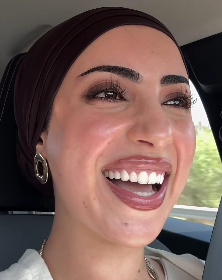 يبخت الشاليموه🥹👃💋🔥 اتأمل فى التفاصيل والبشره المدهننه 👃👃👃👃👃