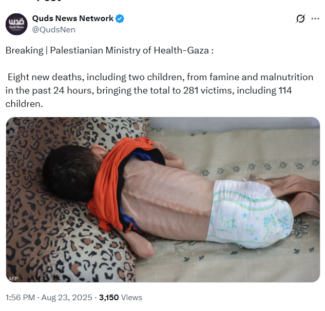 Sofia M. Brigid (@sofia_m_brigid) on Twitter photo 🚨 FAKE ALERT :
<a href="/QudsNen/">Quds News Network</a> claims this child “Died in Gaza today.” Truth : he died in 2024 (on the left) Recycling a dead child twice for propaganda isn’t journalism — it’s grotesque. <a href="/nytimes/">The New York Times</a> <a href="/washingtonpost/">The Washington Post</a> <a href="/DailyMirror/">The Mirror</a>
<a href="/guardian/">The Guardian</a> <a href="/BBCWorld/">BBC News (World)</a> <a href="/lemondefr/">Le Monde</a> <a href="/el_pais/">EL PAÍS</a>
<a href="/IsraelMFA/">Israel Foreign Ministry</a> 🚨 FAKE ALERT :
<a href="/QudsNen/">Quds News Network</a> claims this child “Died in Gaza today.” Truth : he died in 2024 (on the left) Recycling a dead child twice for propaganda isn’t journalism — it’s grotesque. <a href="/nytimes/">The New York Times</a> <a href="/washingtonpost/">The Washington Post</a> <a href="/DailyMirror/">The Mirror</a>
<a href="/guardian/">The Guardian</a> <a href="/BBCWorld/">BBC News (World)</a> <a href="/lemondefr/">Le Monde</a> <a href="/el_pais/">EL PAÍS</a>
<a href="/IsraelMFA/">Israel Foreign Ministry</a>