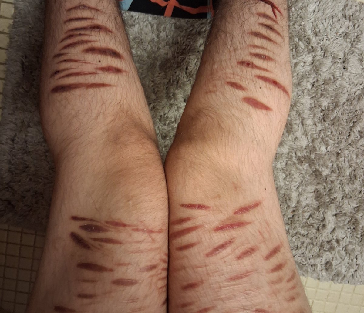 Scar check! Gaze away.
