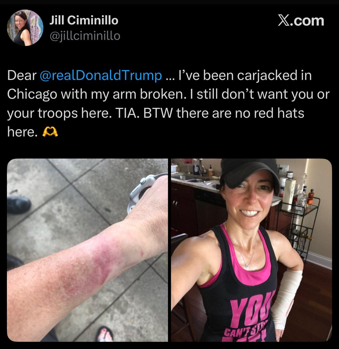 🚨 MENTAL ILLNESS! Liberals in blue cities like Chicago are sending public messages to President Trump that they’re victims of violent crime, but don’t want Trump to lower the crime rate in their city

“I’ve been carjacked in Chicago with my arm broken. I still don’t want your