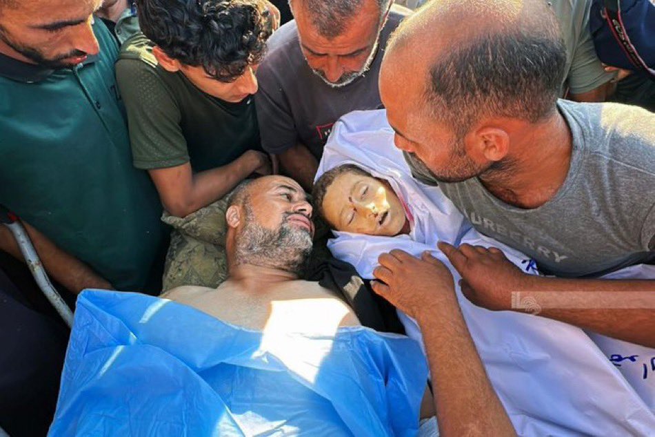 الوداع الأخير .

مشهد مبكي، أب جريح يودع طفله الشهيد.