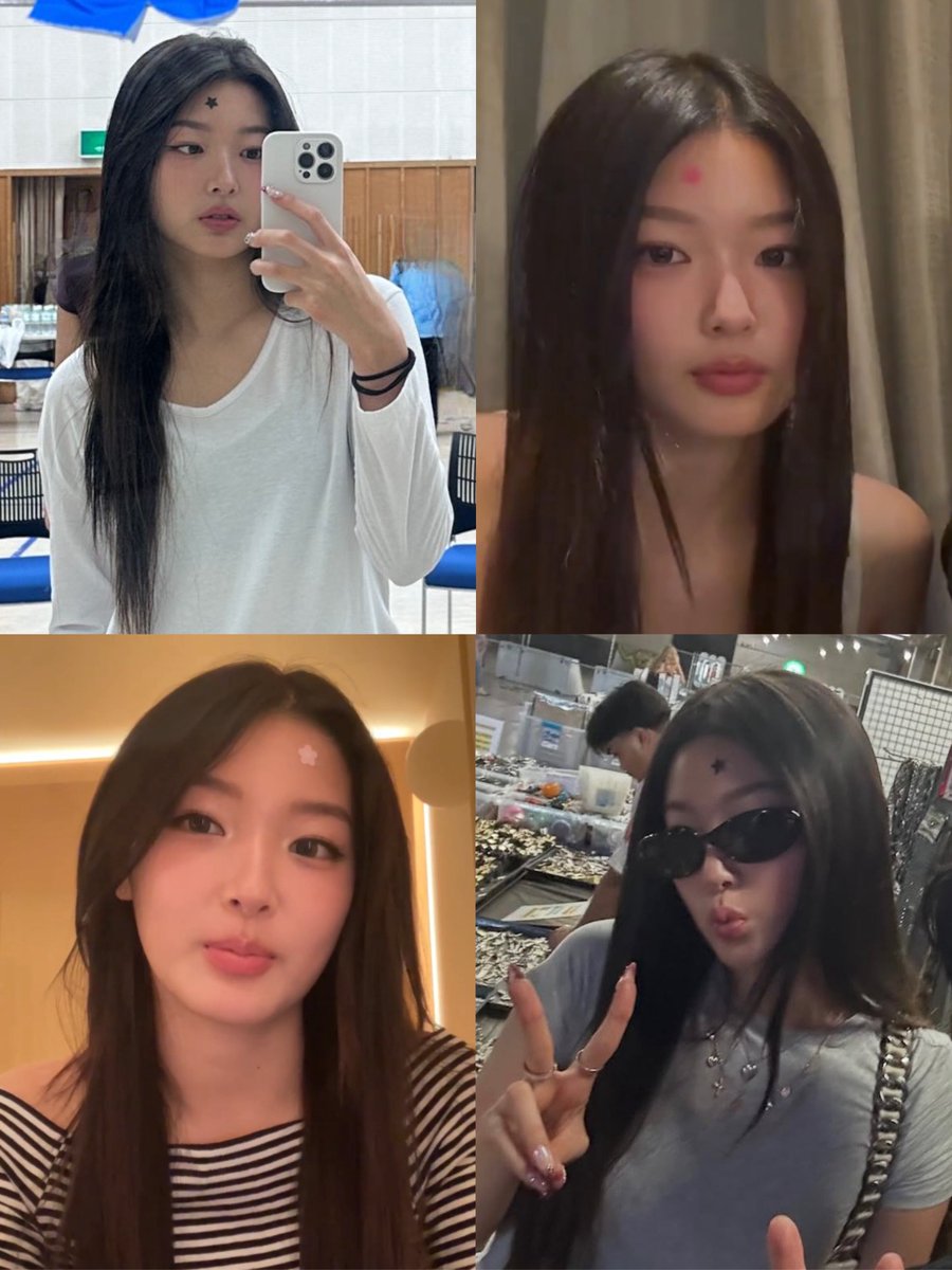 it's yoonchae and her cute pimple patches against the world