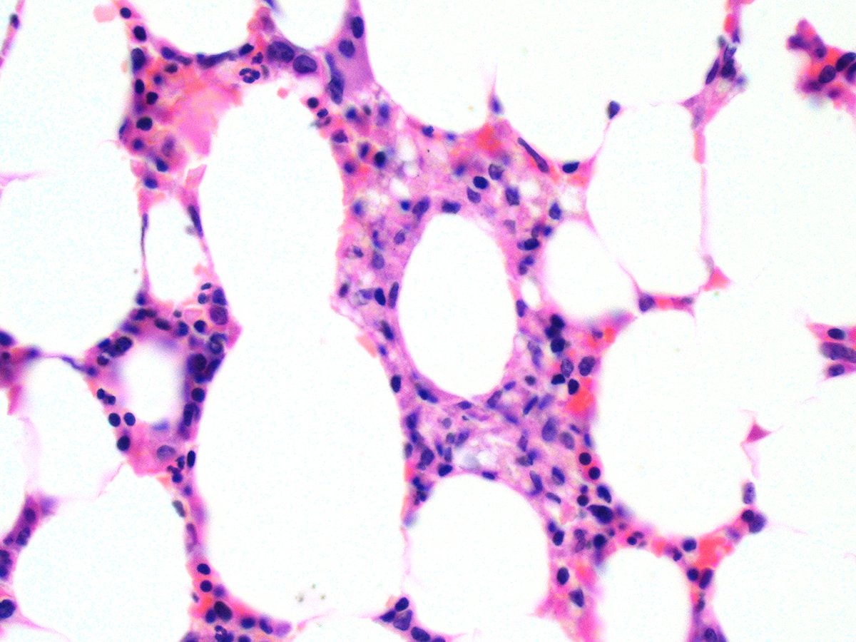 @Hemepathguy tweet media