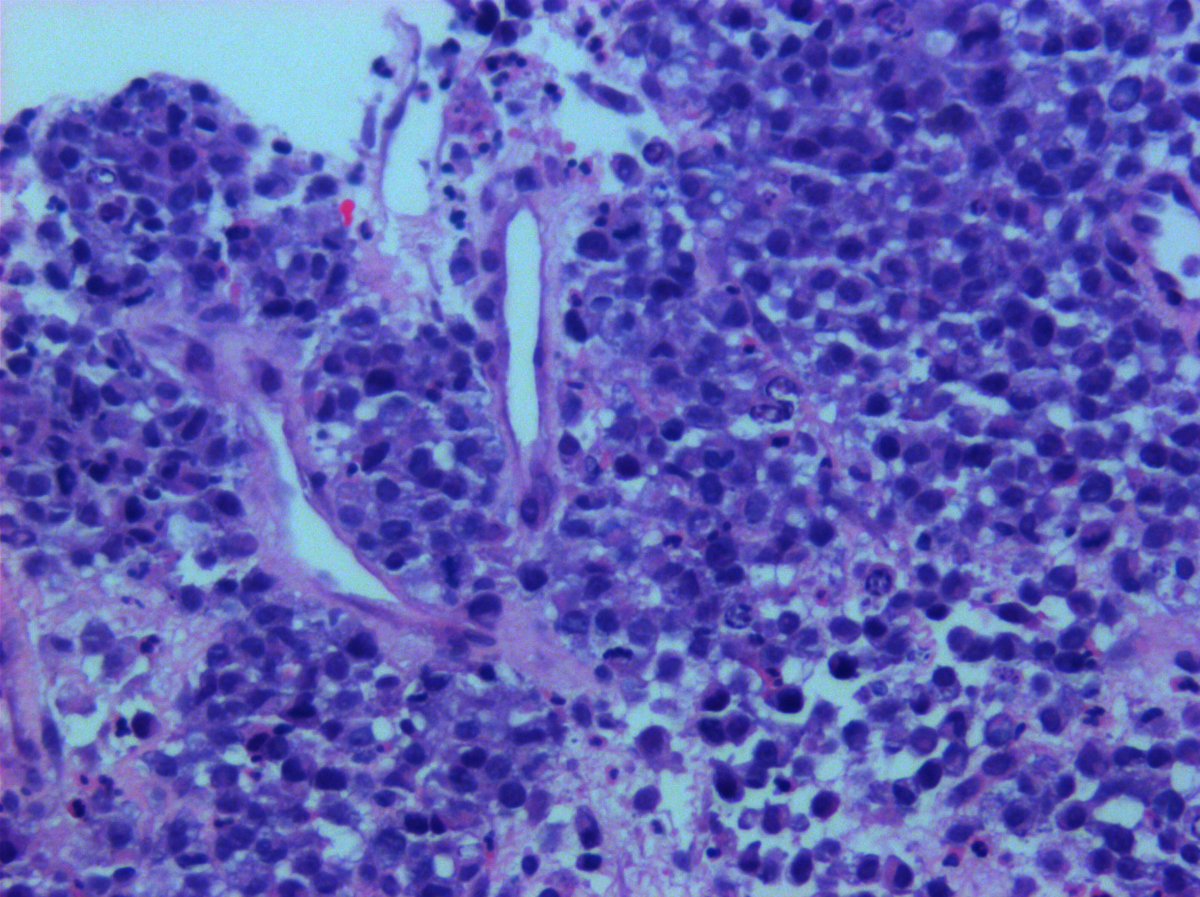 @Hemepathguy tweet media