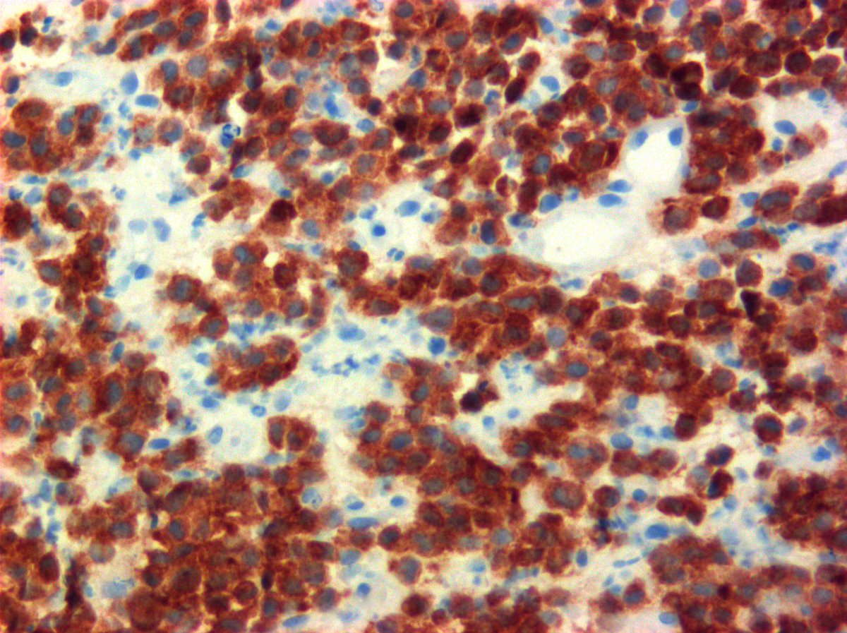 @Hemepathguy tweet media