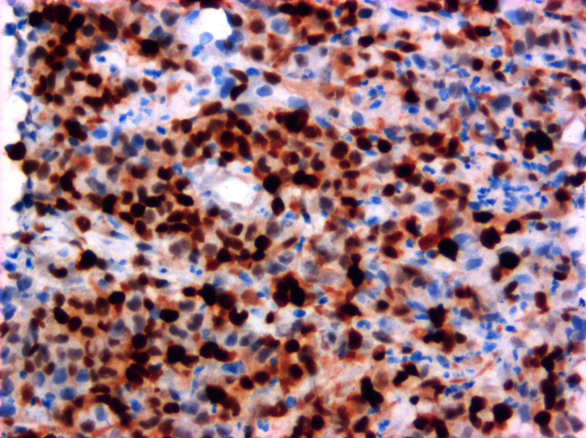 @Hemepathguy tweet media