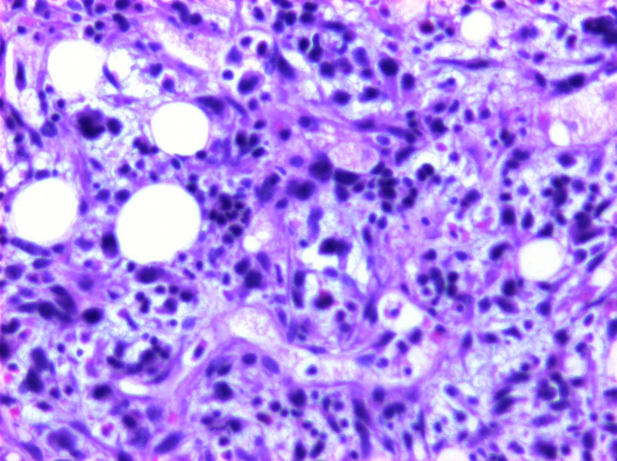 @Hemepathguy tweet media