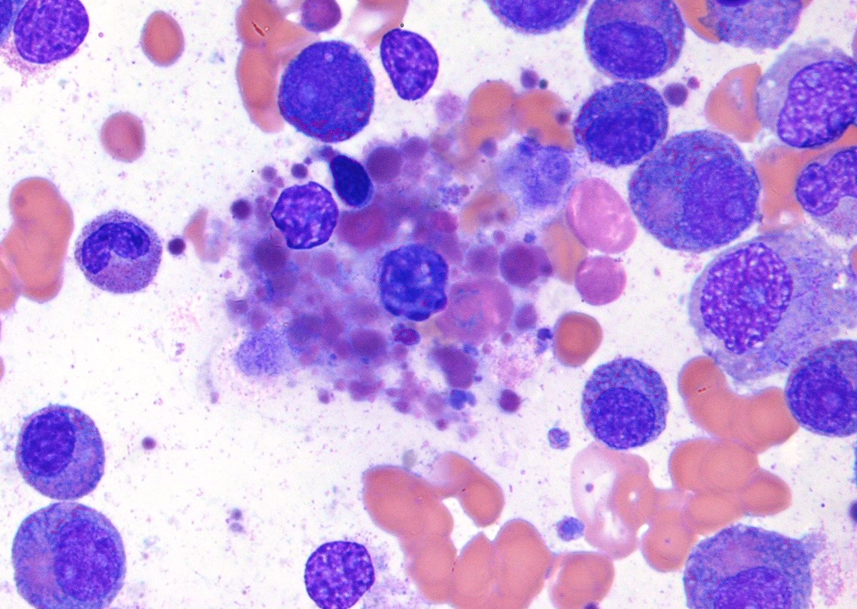 @Hemepathguy tweet media