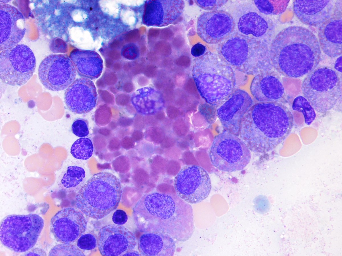 @Hemepathguy tweet media