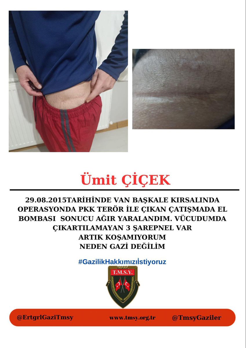 🇹🇷ÖNCE VATAN🇹🇷
KURŞUN YEDİK
MAYIN YEDİK
👇
#GazilikHakkımızıİstiyoruz
☝️
<a href="/RTErdogan/">Recep Tayyip Erdoğan</a>
<a href="/_cevdetyilmaz/">Cevdet Yılmaz</a> 
<a href="/dbdevletbahceli/">Devlet Bahçeli</a>
<a href="/eczozgurozel/">Özgür Özel</a>
<a href="/MahinurOzdemir/">Mahinur Özdemir Göktaş</a>
<a href="/drbetulsayan/">Dr.Betül Sayan Kaya 🇹🇷</a> 
<a href="/hulusiakarmedya/">Hulusi AKAR</a> 
<a href="/dtcuneytaldemir/">Dt. Cüneyt Aldemir 🇹🇷</a> 
<a href="/FeyziBerdibek1/">Feyzi Berdibek🇹🇷</a> 
<a href="/celebimehmeta/">Mehmet Ali Çelebi</a>
<a href="/ifarukaksu/">İsmail Faruk Aksu</a> 
<a href="/kocakkonuralp/">Konur Alp Koçak</a>
<a href="/mhrmkurt/">Muharrem KURT</a>