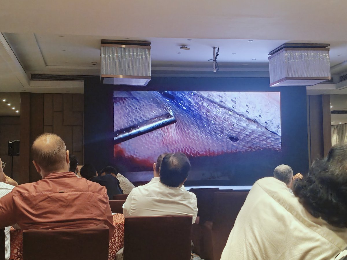 shivanksriv's tweet photo. ⚕️Attended the laparoscopic video case discussion organised by RML Gastrosurgery department,
Pic- Hybrid IPOM https://t.co/YqyEzyFZWe