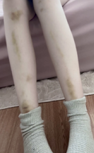 shonshon ๐ (@goodgirlshadow) on Twitter photo Local Schizophrenic White Woman takes on Stairs: the Aftermath Will Shock You Local Schizophrenic White Woman takes on Stairs: the Aftermath Will Shock You