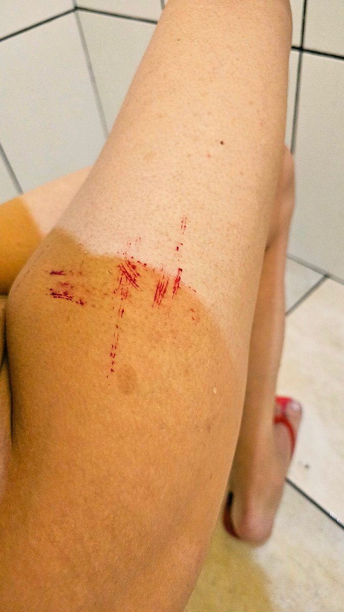 DahSissy's tweet photo. Adoro knife e blood play

#bloodplay #knifeplay

#impactplay #extremebdsm #cdzinha #sissy #femboylegs https://t.co/UdZ07LG36g
