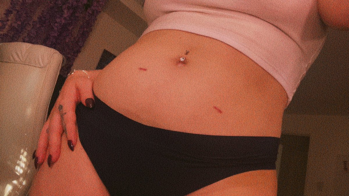 Peach 🪾🌙 Eldritch Apothecary tweet media