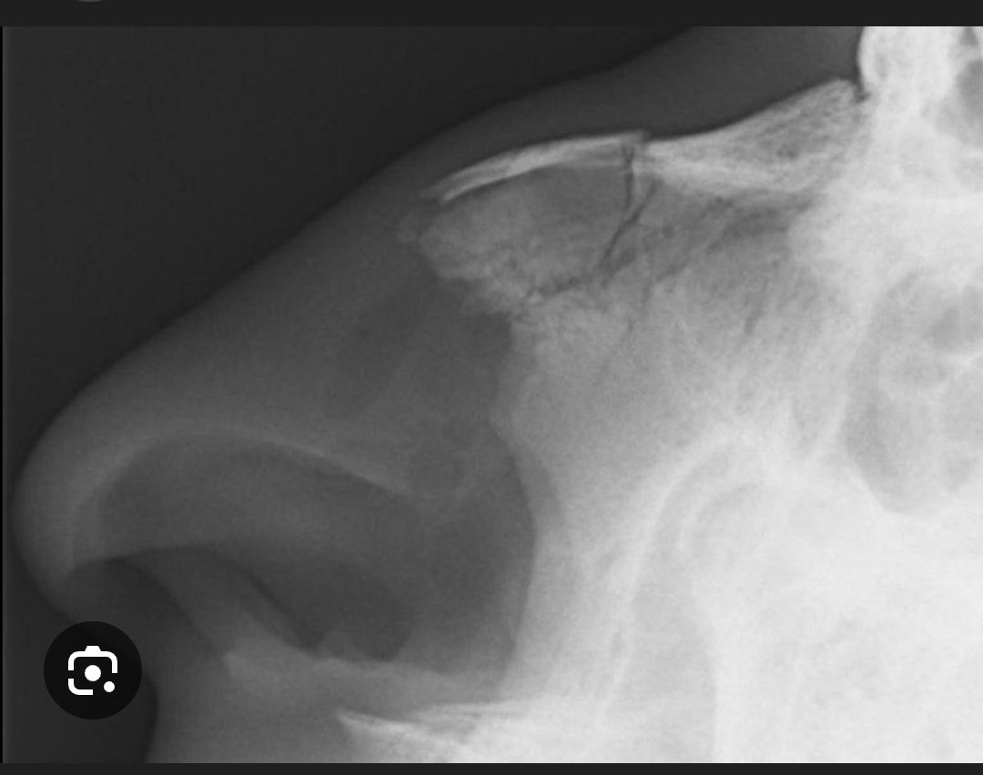 Xayide27 tweet media