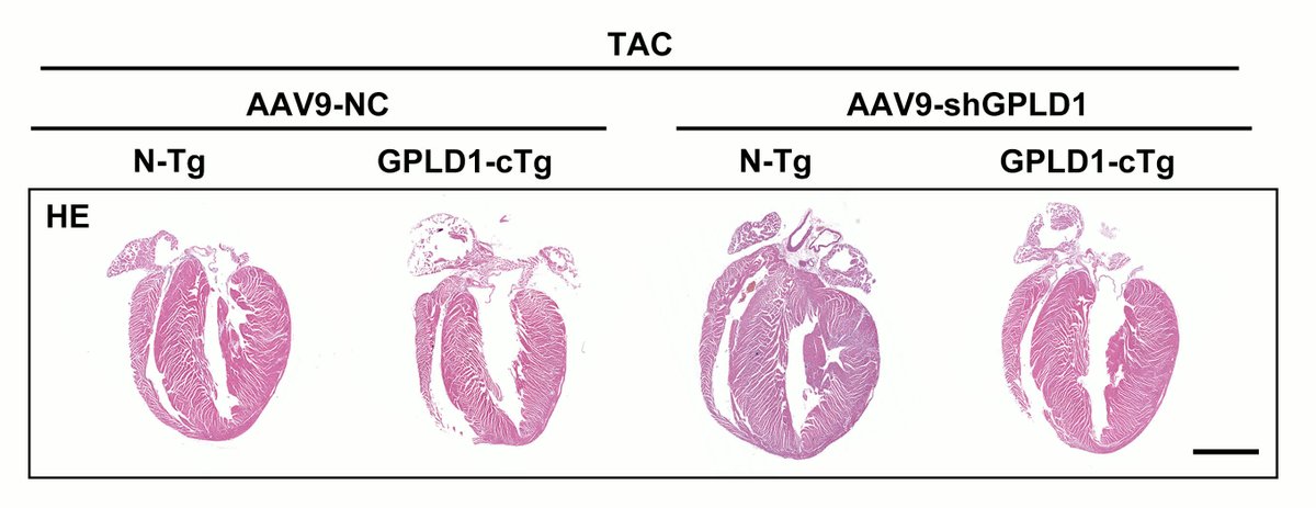 Yu &amp; colleagues found glycosylphosphatidylinositol-specific phospholipase
D1 (#GPLD1) is an endogenous protective factor against #HF. Learn more at ahajrnls.org/4muf2fl 
<a href="/TaroYu25/">TaroYu</a> <a href="/ZSky17/">Zhen Guo</a> <a href="/Alicardsdoc/">Ali Javaheri</a>