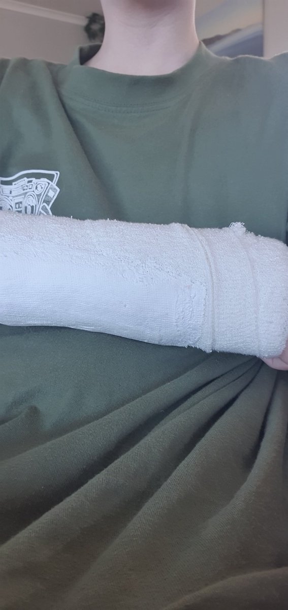 POV: You broke your arm AGAIN 🙄

<a href="/Ronin_Network/">Ronin</a> <a href="/TriballyGames/">Tribally 🎮</a>