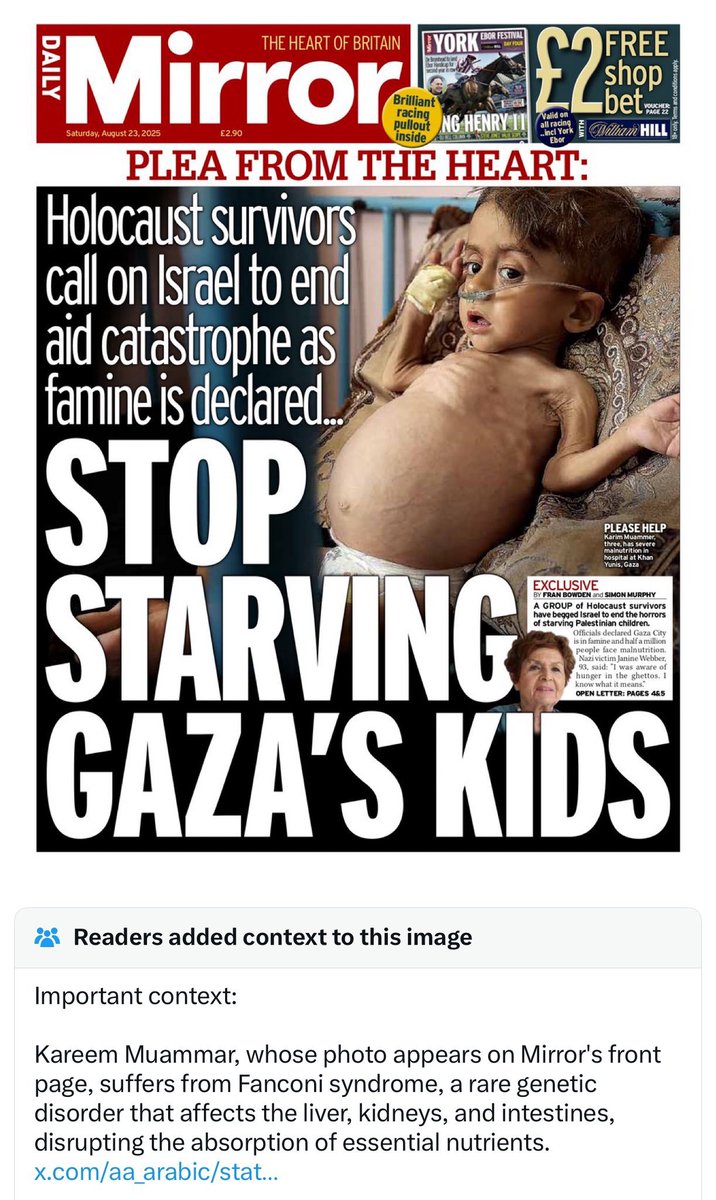 The Daily Mirror knowingly used a child with a rare genetic disorder to smear Israel.

They knew the truth.
They ran the lie anyway.

This isn’t journalism. It’s incitement.
