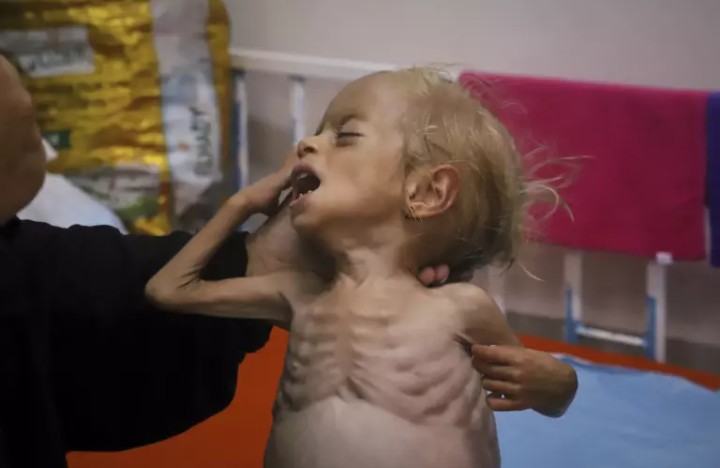 AlmaguerPerdomo's tweet photo. Mientras #NetanyahuGenocida niega descaradamente la existencia de hambruna en Gaza han muerto más de 260 personas por desnutrición, la mayoría niños.
¡Es una vergüenza para el mundo!
#FreePalestine https://t.co/0jw1BLXcRR