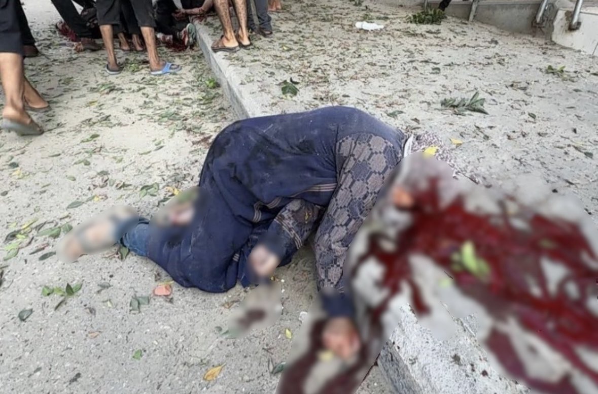 صمت لم تعرفه البشرية من قبل 

هل يُعقل هذا الصمت امام هذا المشهد 

نساء المسلمين في غزة يُذبحون يا عالم !!