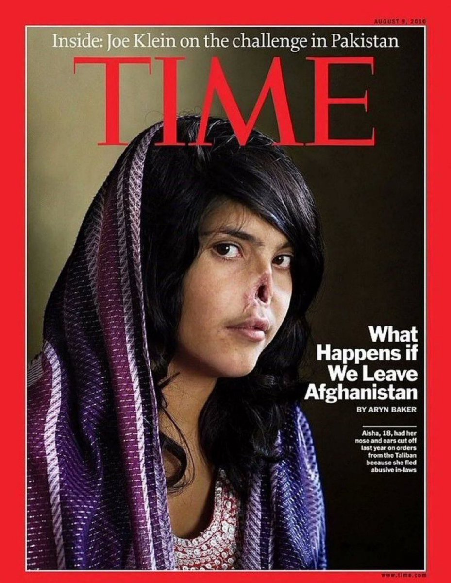 Islam for You!

🇦🇫 Afghanistan: She’s Ayşe Bibi. 

Her husband cut off her nose and ears in an Afghanistan ruled by Sharia law.

She was given to a Taliban jihadist with hier sister. 

At 12, in return for his father's debts.

She attempted to run away from home and was punished!