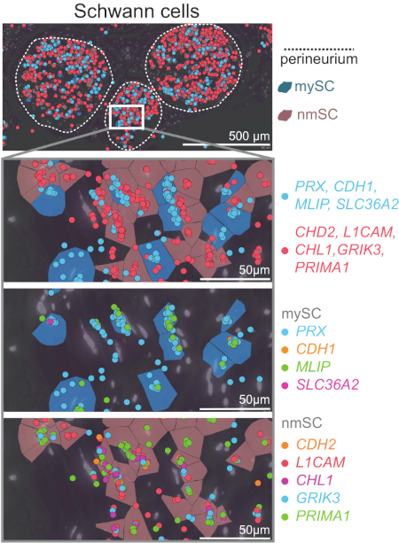 5/13 We identified novel and human-specific nerve cell type markers using snRNA-seq, which were validated using spatial transcriptomics