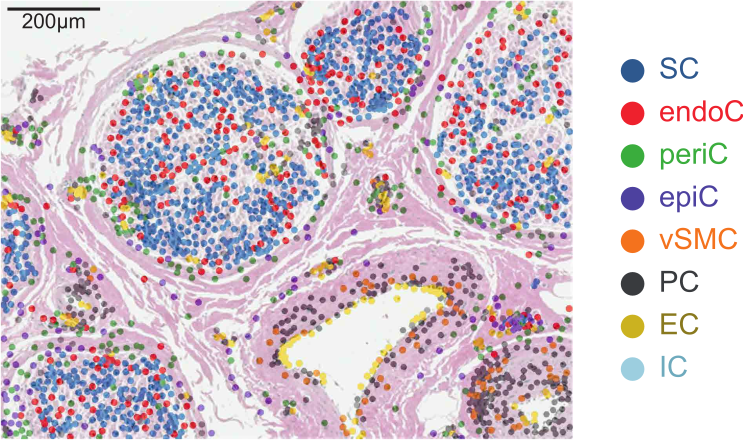 6/13 Integrating spatial transcriptomics with snRNA-seq provided an unbiased histological annotation of peripheral nerve cells.