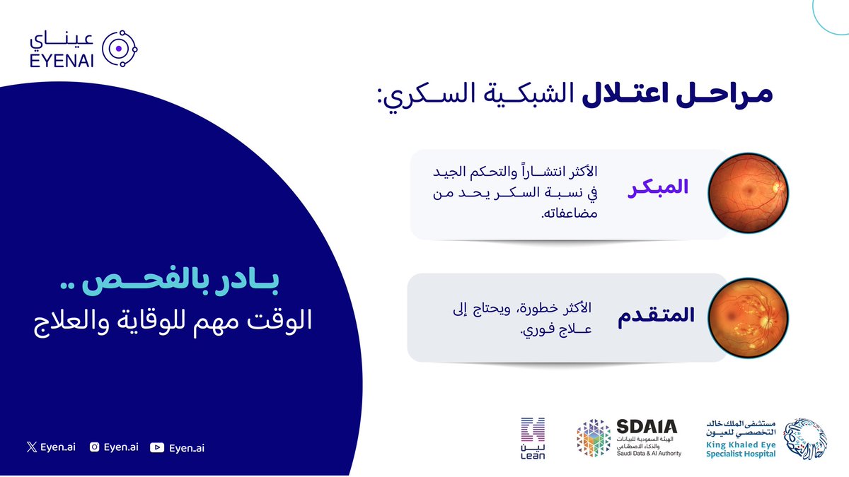 ️ مراحل اعتلال الشبكية السكري👁

#عيناي ابتكار سعودي للوطن 🇸🇦
#تقنية عيناي تشوفه
 #لا_تنتظر ⏳
#اعتلال الشبكية السكري