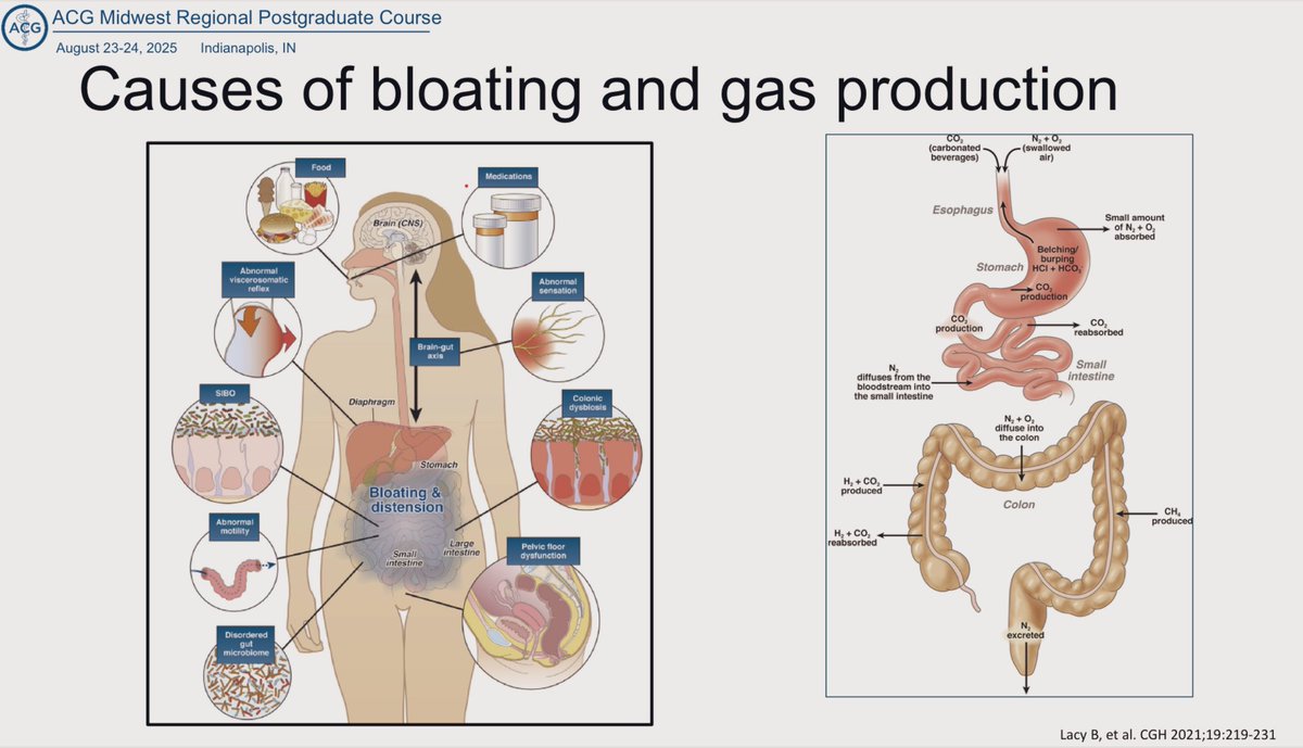Bloating VERY common concern patients bring to GI visits.

<a href="/BMoshiree/">Baha Moshiree MD, MSci, FACG, AGAF</a> did masterful job walking us through bloat/gas.

Things to consider:
🔹Constipation
🔹Lactose
🔹FODMAPs
🔹Other foods
🔹Meds
🔹GI disorders
🔹Don’t overlook ovarian cancer!

#ACGMWRegional
<a href="/AmCollegeGastro/">ACG</a>
