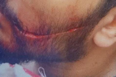 sayedmaheratia's tweet photo. لسه حالا 
في المستشفي عندنا في سيد جلال الجامعي 

طبيب امتياز من الناس المجتهده المشهود لهم بالشطاره 
دخل عليه بلطجي وبالمشرط في وشه 

مش عارف لحد امتي هنفضل كده 
امن مش بيعمل اي حاجه (مجرد صوره وخلاص)
بيئة عمل غير ادميه لاتصلح للعمل 
وفي الاخر هو ده المقابل !!! https://t.co/UMDSNGmgWZ