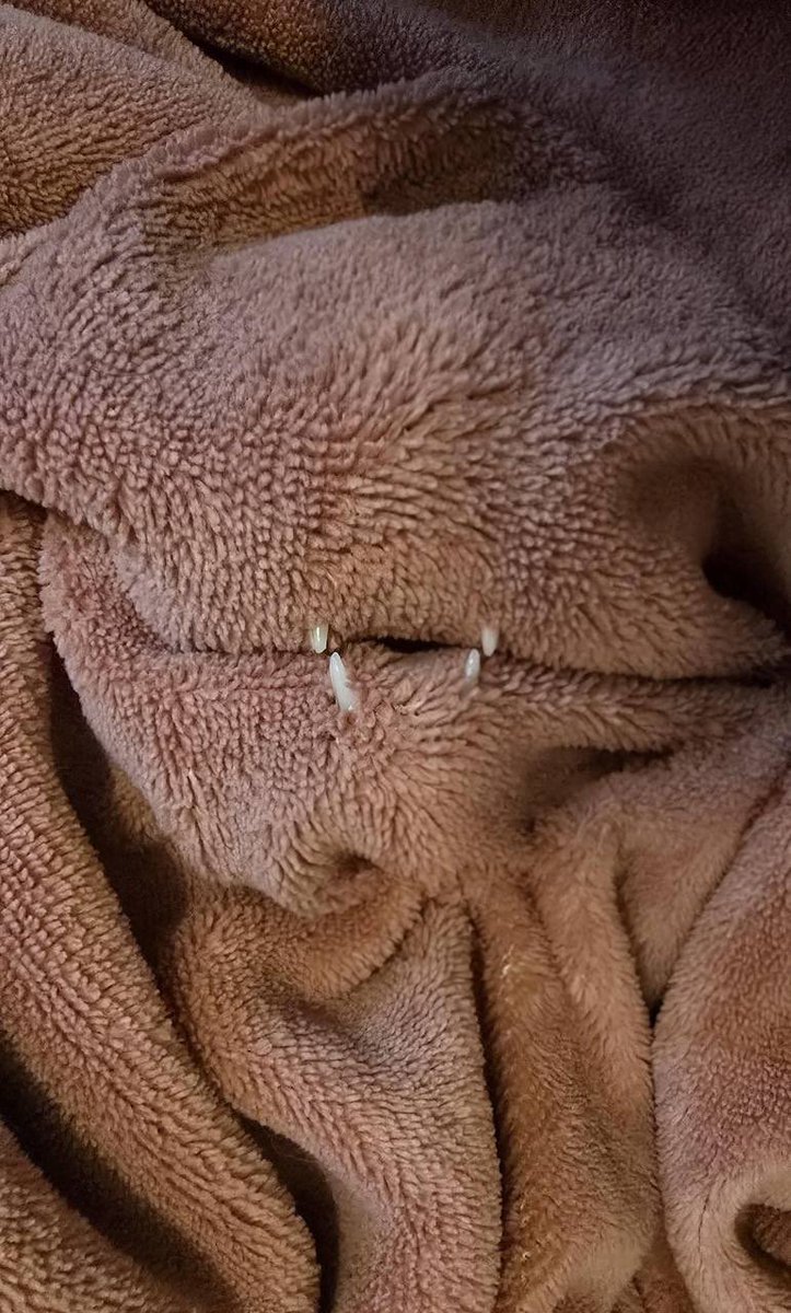 Шанс быть укушенным пледом низок, но никогда не равен нулю