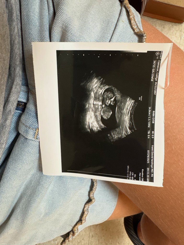 We’ve been keeping a pretty big secret. We’ve been so on the fence about posting this BUT 

A handsome baby boy will be joining our family in February 2026! 

He is our 4th and final baby please keep all comments kind! We weren’t going to post but we’re too excited