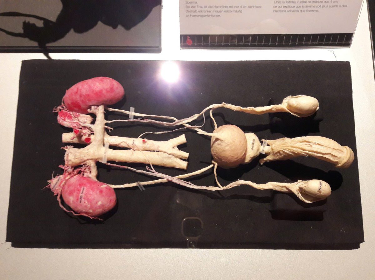 Male reproduction system. 
I want to cut yours out and display it for all to see.
 #penis #dick #cock

#阉割 #公肉 #meat #meatypenis #castration #catchym