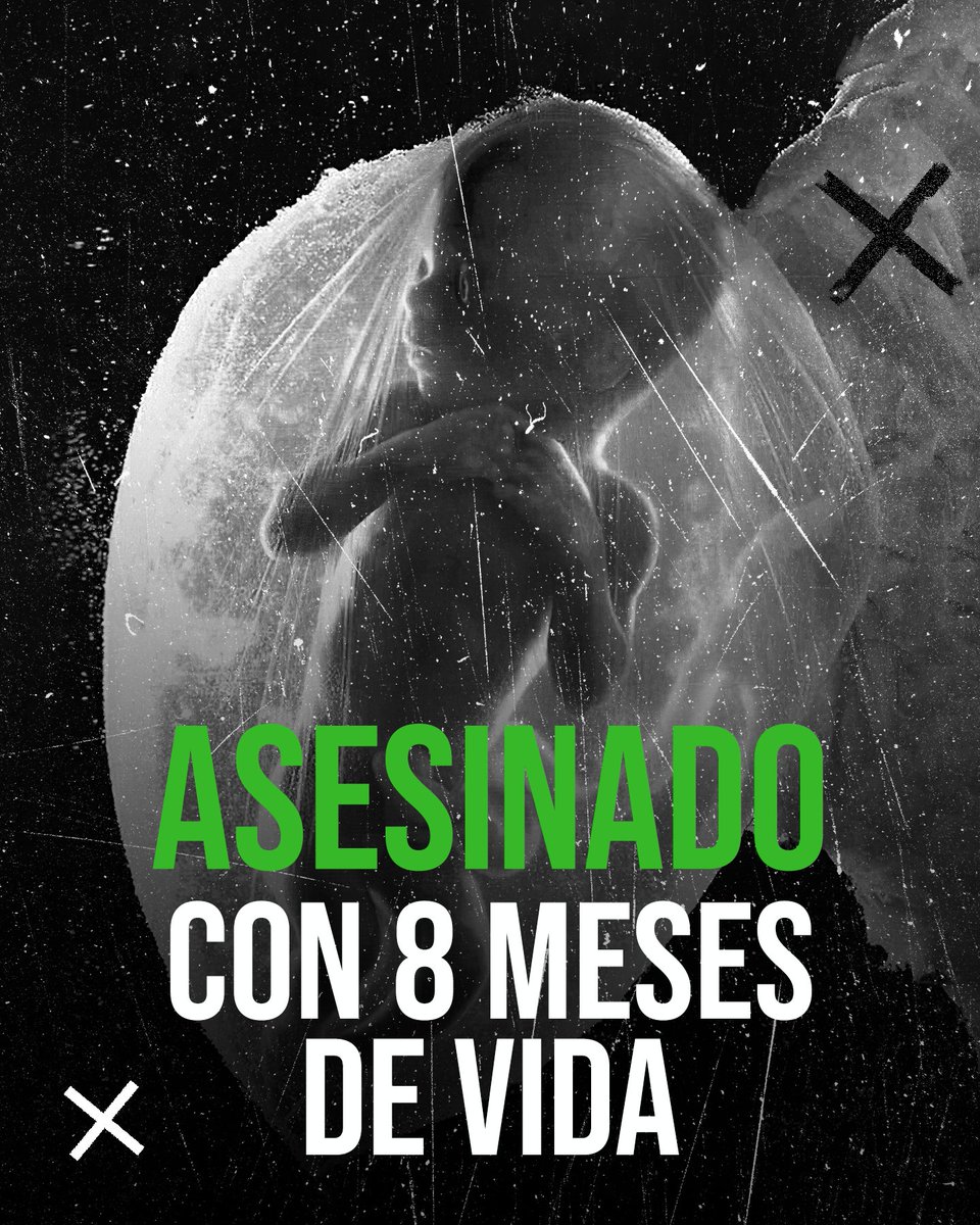 📍 En Córdoba hicieron un aborto tras 32 semanas (casi 8 meses) de embarazo.

👶 El bebé ya era viable y con grandes chances de sobrevivir.

⚖️ Lamentablemente, la nefasta ley de aborto lo permite.