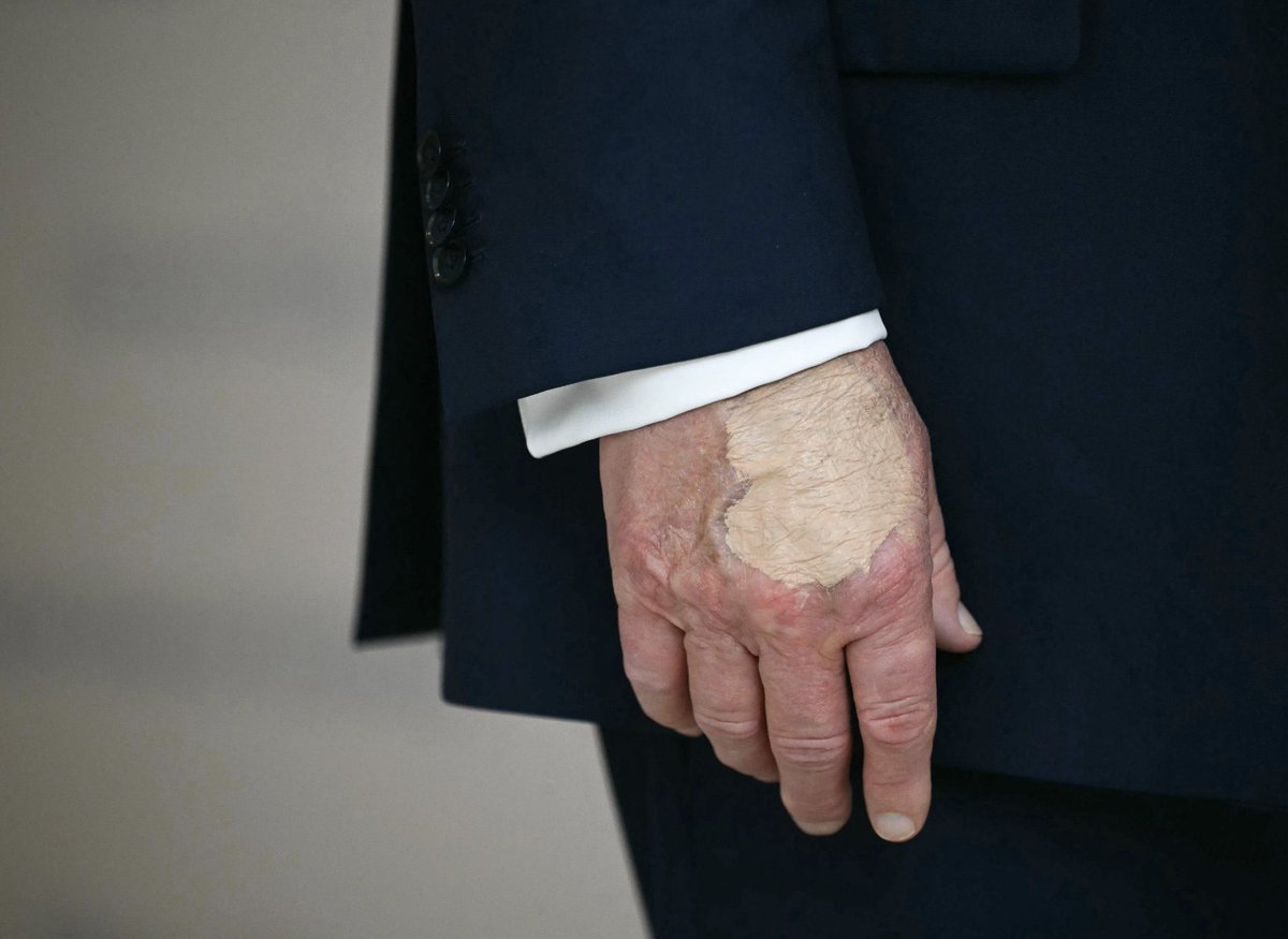 ProjectLincoln's tweet photo. It's been 14 days since Trump last golfed. He's obviously weak and tired. What else aren't they telling us about his health? https://t.co/91WjWlmkrh
